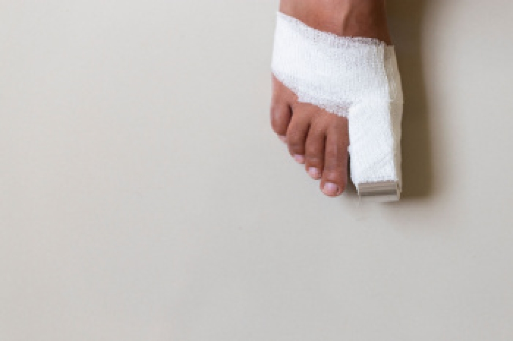 Broken Toe Treatment