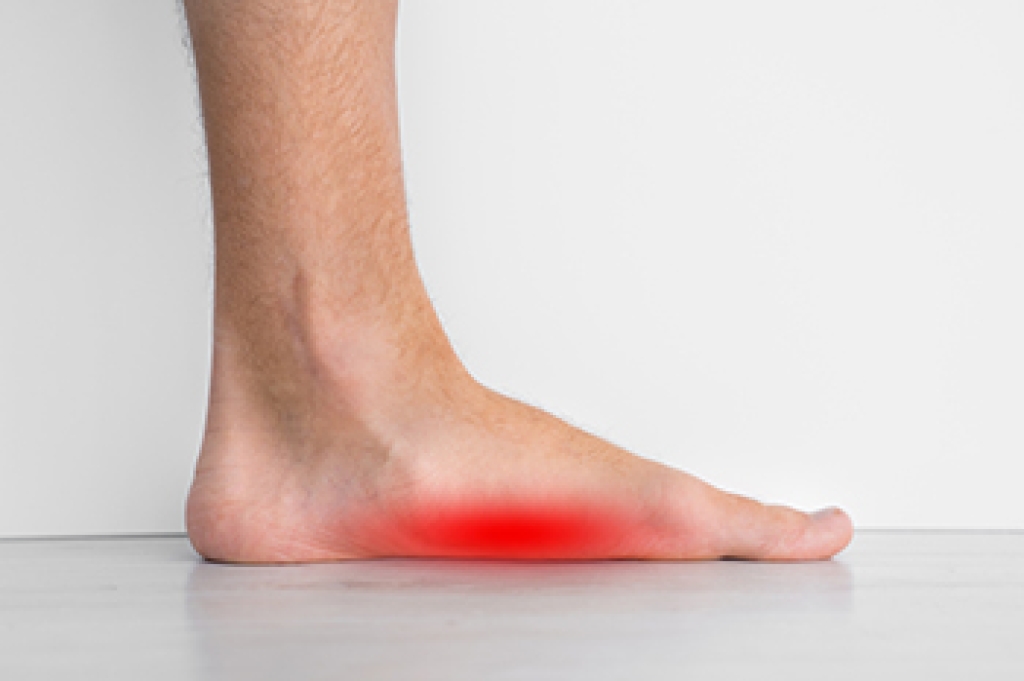 Flat Feet Causes and Long-Term Foot Health