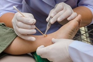 Treatment Options for Foot Ulcers