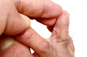Healthy Habits for Better Foot Hygiene