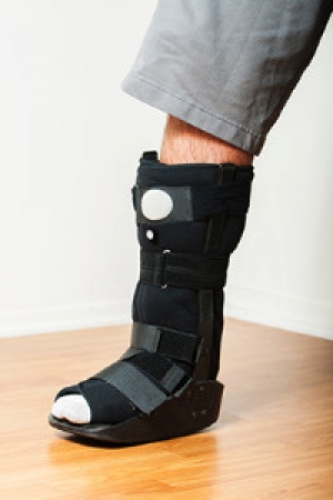 The Bones in the Feet May Fracture Easily
