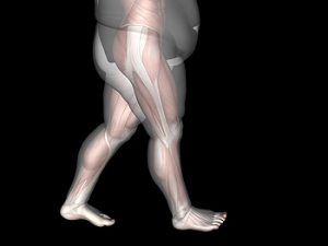 Certain Foot Conditions May Be Linked to Obesity