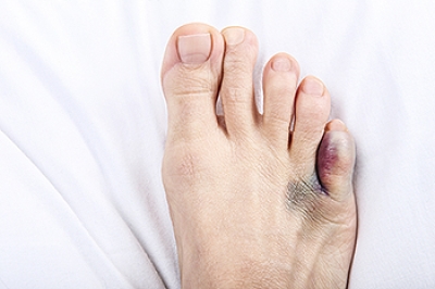 Causes of Pain in the Pinky Toe