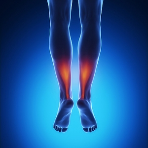 Where Is the Achilles Tendon Located?