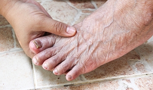 Symptoms of a Toenail Fungus