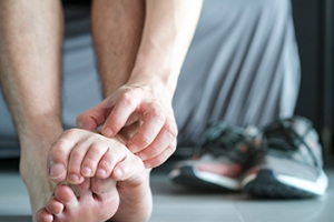 Categories of Athlete’s Foot