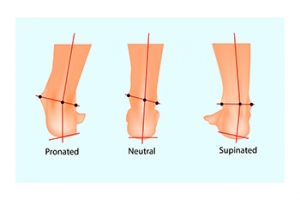How Supination Affects the Feet