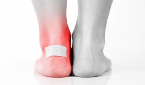 The Early Warning Sign of Blisters