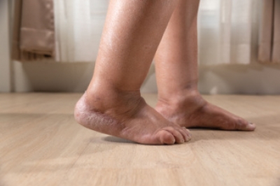 Swollen Feet or Ankles May Signal Other Problems