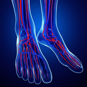 What is Hereditary Erythromelalgia?